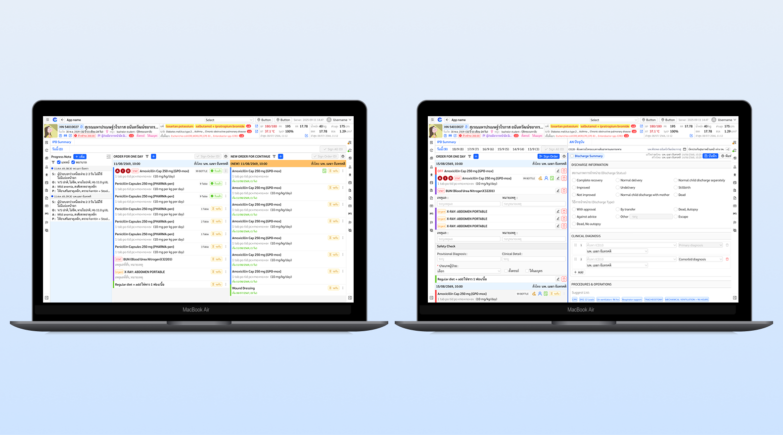 Redesigning IPD Order Summary case banner